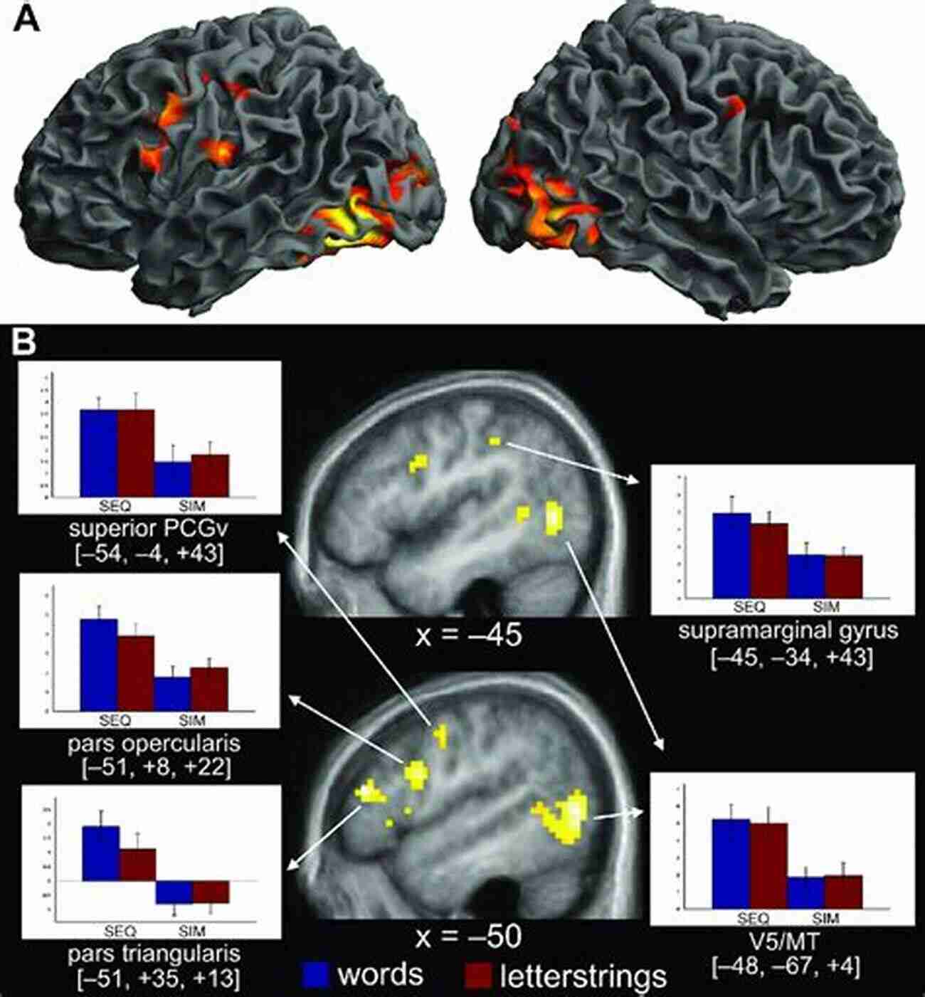 Neuroimage Showing Brain Areas Activated During Political Decision Making Inside The Mind Of A Voter: A New Approach To Electoral Psychology