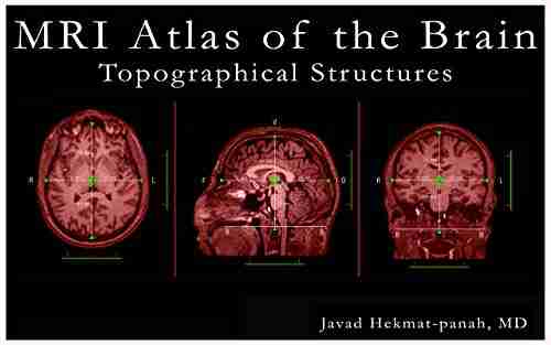 MRI Atlas of the Brain: Topographical Structures